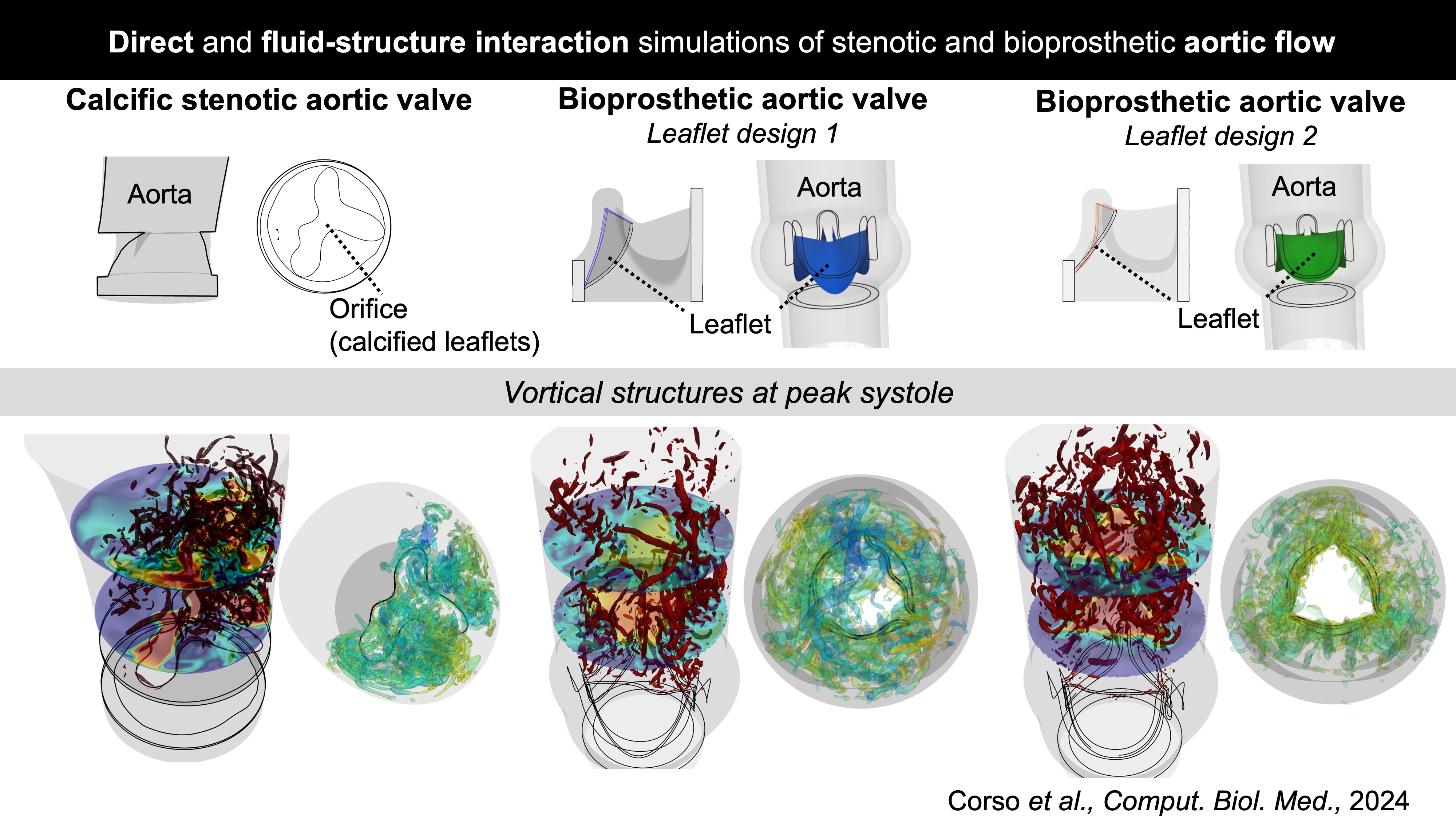Vortical structures downstream of stenotic and bioprosthetic aortic valve - computational FSI study